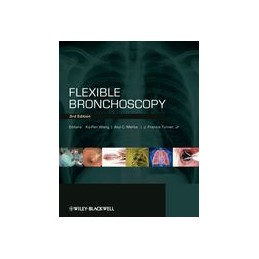 Flexible Bronchoscopy