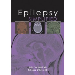 Epilepsy Simplified