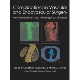 Complications in Vascular &...