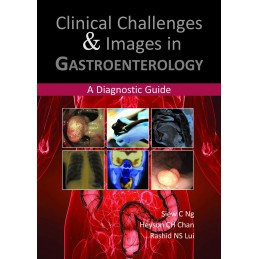 Clinical Challenges & Images in Gastroenterology: A Diagnostic Guide