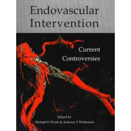 Endovascular Intervention:...