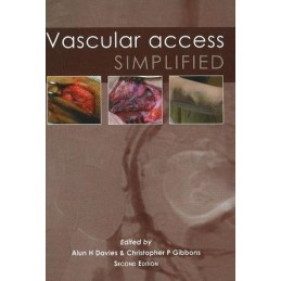 Vascular Access Simplified:...