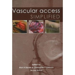 Vascular Access Simplified: 2nd Edition