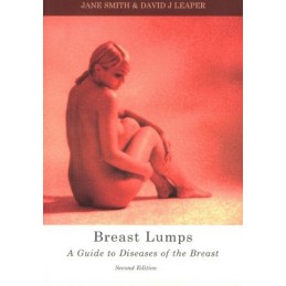 Breast Lumps: A Guide to...