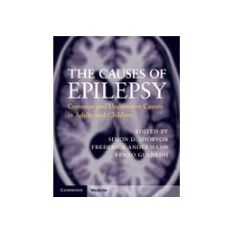 The Causes of Epilepsy:...