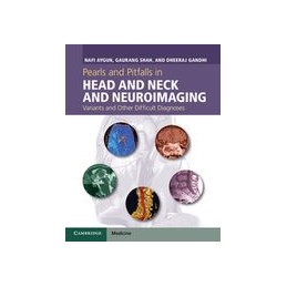 Pearls and Pitfalls in Head and Neck and Neuroimaging: Variants and Other Difficult Diagnoses