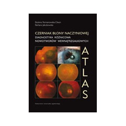 Czerniak błony naczyniowej - atlas