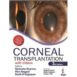 Corneal Transplantation: with Videos