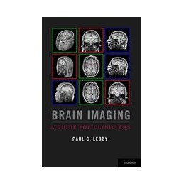 Brain Imaging