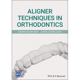 Aligner Techniques in Orthodontics