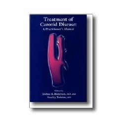 Treatment of Carotid Disease