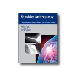 Shoulder Arthroplasty