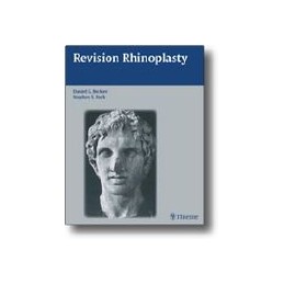 Revision Rhinoplasty