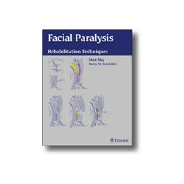 Facial Paralysis