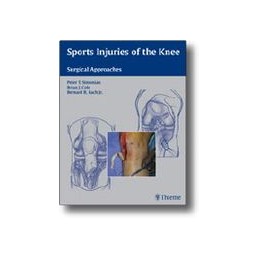 Sports Injuries of the Knee