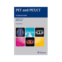 PET and PET/CT