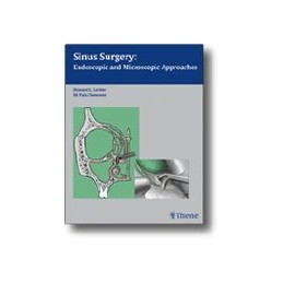 Sinus Surgery