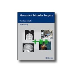 Movement Disorder Surgery