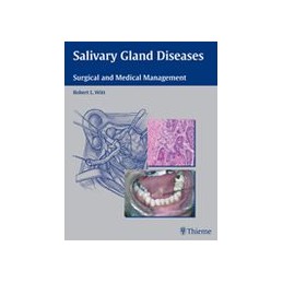 Salivary Gland Diseases