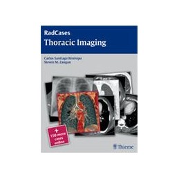 Radcases Thoracic Imaging