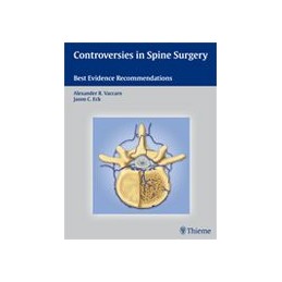 Controversies in Spine Surgery: Best Evidence Recommendations