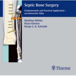 Septic Bone Surgery