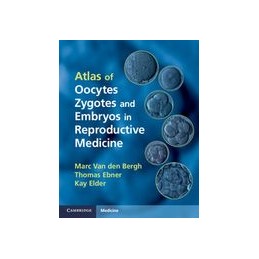 Atlas of Oocytes, Zygotes and Embryos in Reproductive Medicine Hardback with CD-ROM