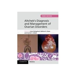 Altchek's Diagnosis and Management of Ovarian Disorders