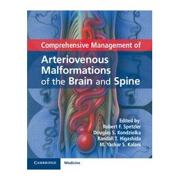 Comprehensive Management of Arteriovenous Malformations of the Brain and Spine