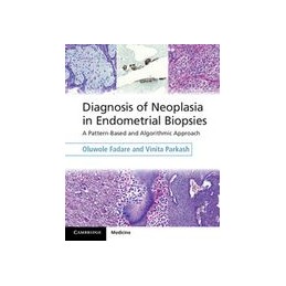 Diagnosis of Neoplasia in...