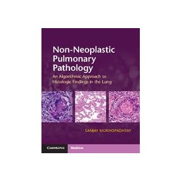 Non-Neoplastic Pulmonary...