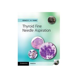 Thyroid Fine Needle...