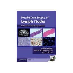 Needle Core Biopsy of Lymph...