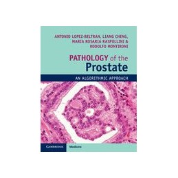 Pathology of the Prostate  : An Algorithmic Approach