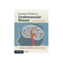 Common Pitfalls in Cerebrovascular Disease: Case-Based Learning