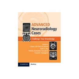 Advanced Neuroradiology Cases: Challenge Your Knowledge