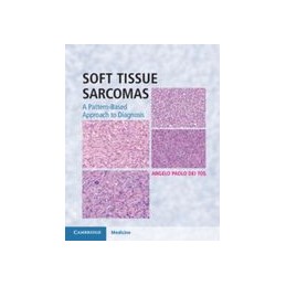 Soft Tissue Sarcomas...