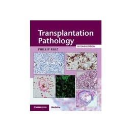 Transplantation Pathology...