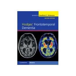 Hodges' Frontotemporal...