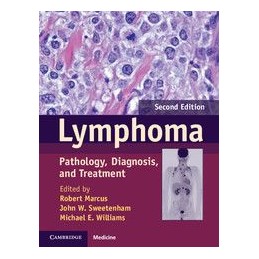 Lymphoma: Pathology, Diagnosis, and Treatment