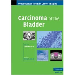 Carcinoma of the Bladder