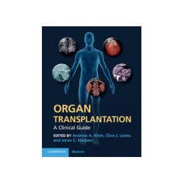 Organ Transplantation: A Clinical Guide