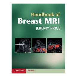 Handbook of Breast MRI