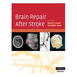 Brain Repair After Stroke