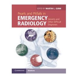 Pearls and Pitfalls in Emergency Radiology: Variants and Other Difficult Diagnoses