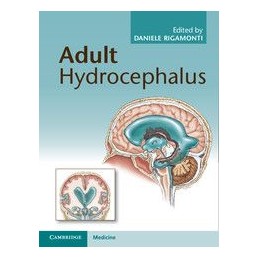 Adult Hydrocephalus