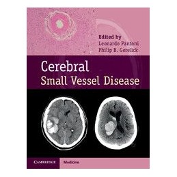 Cerebral Small Vessel Disease