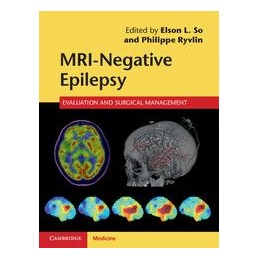 MRI-Negative Epilepsy:...