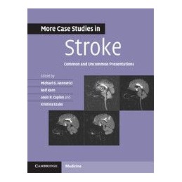More Case Studies in Stroke: Common and Uncommon Presentations