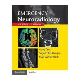 Emergency Neuroradiology: A...